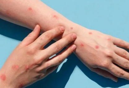 Chủng virus mới vượt khỏi khả năng giám sát khiến WHO phát động chiến dịch toàn cầu diễn biến như thế nào ở Việt Nam?