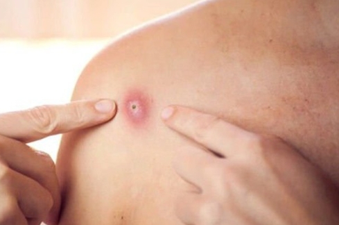 Vì sao chủng virus mới khiến WHO thông báo tình trạng khẩn cấp lại xuất hiện nhiều hơn ở nam giới?