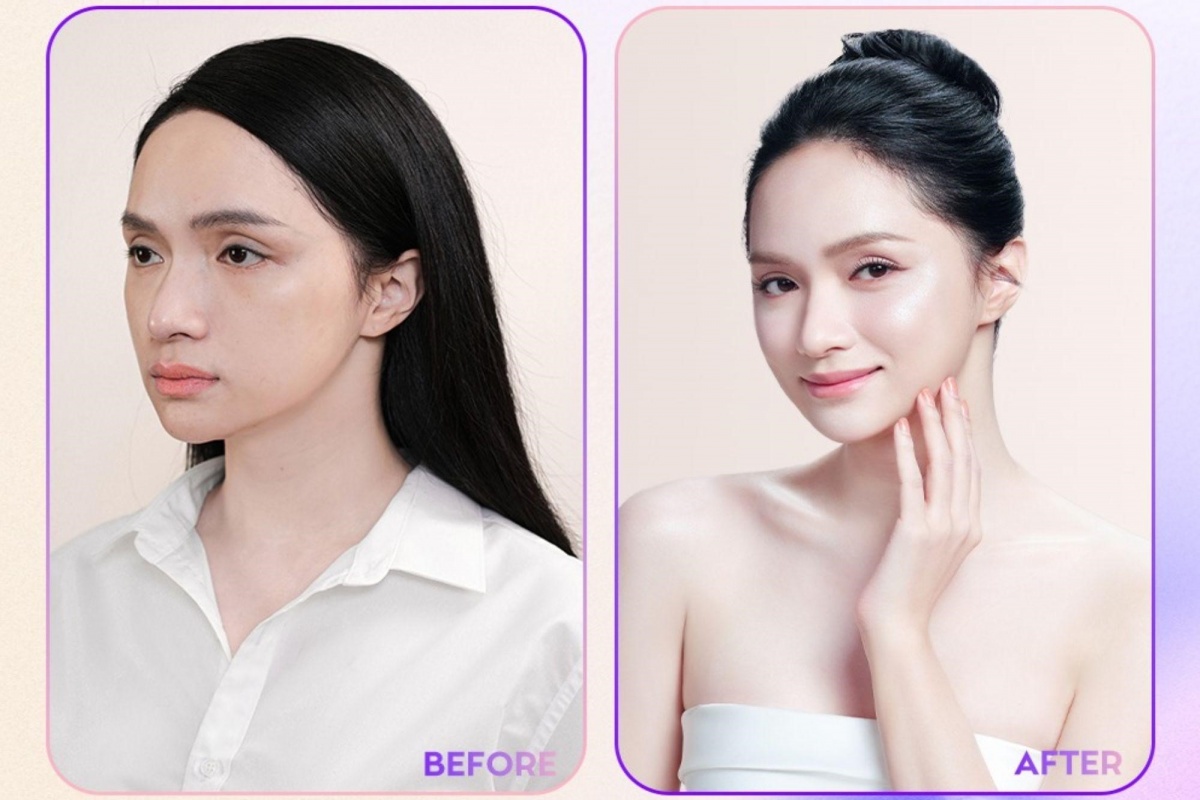 Lên hương nhan sắc không cần “dao kéo” cùng Thẩm mỹ viện Linh Anh