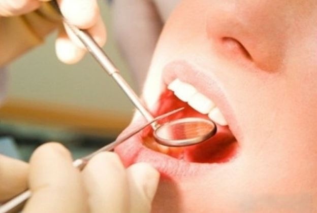 Học kiến thức trên mạng, thanh niên 22 tuổi tự xưng là nha sĩ đã mở phòng khám 'chui' chữa trị cho hàng chục người